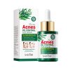 SADOER Tea tree ACNES Oil Control Face Serum