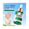 SADOER Tea tree ACNES Oil Control Face Serum