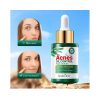 SADOER Tea tree ACNES Oil Control Face Serum